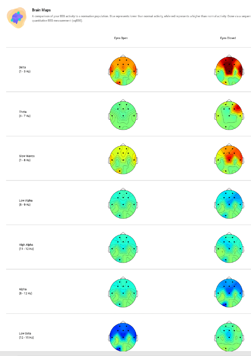 BrainChecker - At-Home qEEG Brain Scans & Neurofeedback